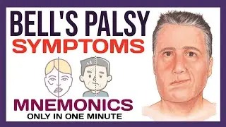 Bell's Palsy Symptoms | Mnemonics