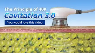 The Principle Of 40K Cavitation 3.0. The Most Advanced Technology Ever. 