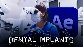 Motion Video Advt (subject: dental implants)
