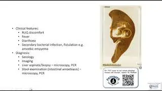 Liver: Amoebic abscess - Virtual microscopy (Talking slide)