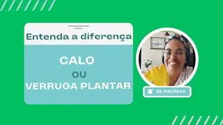 Calo X verruga plantar ? Saiba mais sobre suas diferenças aqui neste vídeo