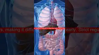 The Links Between Asbestos Exposure and Mesothelioma Cancer? 