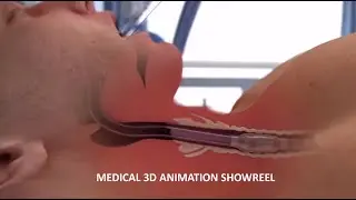 Arcreative - Medical Showreel (3D Animation)