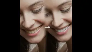 Teeth Scalling in photoshop | Shrot Clip