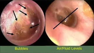 Ear Examination