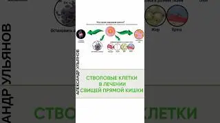Стромально-васкулярная фракция в лечении свищей прямой кишки. #проктолог #доктор  #shorts #медицина