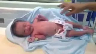 Newborn babies Just afterbirth #baby #shorts