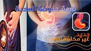 علاج النهائي بدون أدوية، قرحة المعدة و المرئ، نهاية أدوية الحموضة