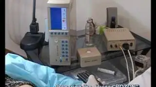 Subcutaneous injection of ozone-oxygen mixture