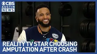 MTV star Nelson Thomas renews faith, chooses amputation year after accident