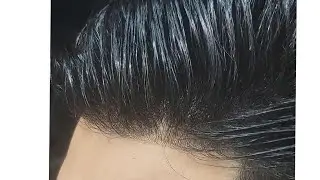 لية تعمل زراعة الشعر لما ممكن تركب الشبكية الفرنسية في ساعة زمن واحدة !!