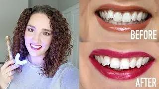 Snow Teeth Whitening Review - Best Teeth Whitening for Sensitive Teeth