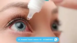 Are you confused about your eye reports? 🤔