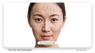 AR Technologies Acne Removal (Tap)