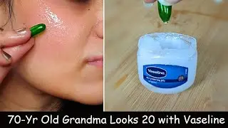 I Apply Vaseline + Aloe vera Gel + Vitamin E Oil on Face & Removed Wrinkles - Skin Whitening Cream