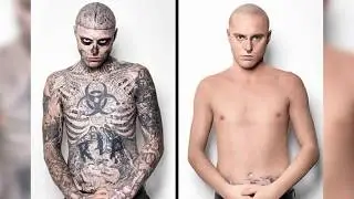 ’Before and After’ Photos That Are Difficult to Tear Our Eyes Away From