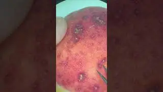 Абрикос заболел 