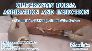 OLECRANON BURSA ASPIRATION / INJECTION - In-Vivo Series