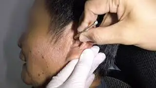Something Stuck in Grandpa's Ear