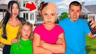 Our Daughter Lani Hair Fell Out….💔