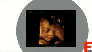 Рон Гутман Тайная сила улыбки_Часть 1 480p online video cutter com