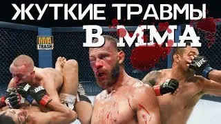 ЖУТКИЕ ТРАВМЫ В ММА! 