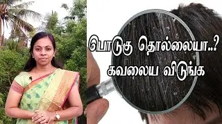 இதை செய்யுங்க பொடுகு தொல்லையிலிருந்து ஒரே நாளில் விடுபடலாம்...!