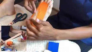 Кинезиотейпирование