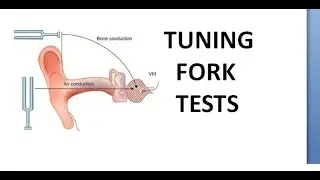 ENT Tuning fork tests Rinne Weber Absolute Bone Conduction Schwabach Bing Gelle