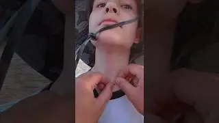 Как вытащить клеща ниткой. сын поймал клеща