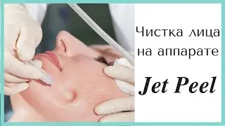 Газожидкостный пилинг лица Джет Пил (Jet Peel). Отзыв