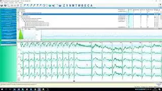 KTResult3 - кнопки разметки ритма
