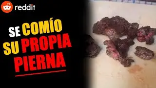 El tipo de Reddit que se COMIO su propia PIERNA. (Receta en la descripción)