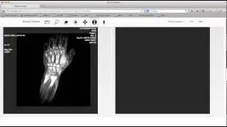 dicom-viewer-6