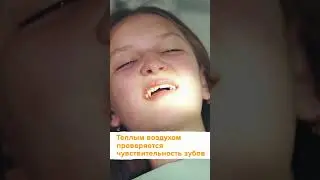 Зачем стоматолог стучит по зубам?