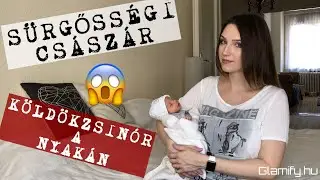 Nimród születése - sürgősségi császármetszés