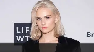 10 Unusual Models In The Fashion Industry