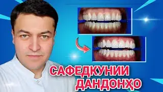 Сафедкунии дандонҳо