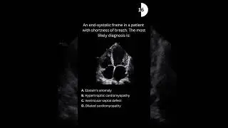 Echocardiography board practice question #10