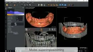 QuickVision 3D Tutorials - Superimpositioning