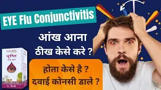 Eye flu #conjuctivitis आँख आ जाये तो क्या करे ? #patanjali #eyedrop डाले ?  #eye #eyeflu #health