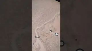 I Put Clorox on my Blood Under the Microscope 