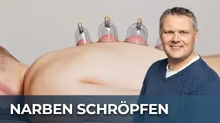 Schröpfen bei einer Narbenstörung gefährlich? Was Du wissen musst