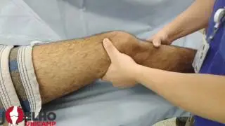 Teste de Lachman