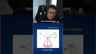 👨🏻‍⚕️♥️Локализация инфаркта миокарда с подъемом сегмента ST.