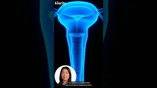 What Is Uterine Prolapse? #shorts