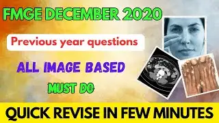 FMGE DECEMBER 2020 PREVIOUS YEAR image based questions revisions #fmge #neetpg #mbbs #next #fmge2023