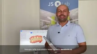 Registrace mezičelistních vztahů pomocí intraoráního skeneru