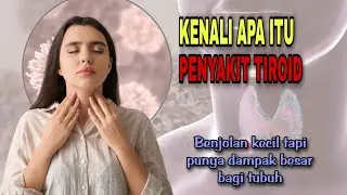 Penyakit Tiroid : Kenali Kelenjar Kecil yang Punya Dampak Besar