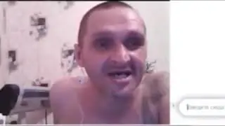 ВИЧ головного мозга.